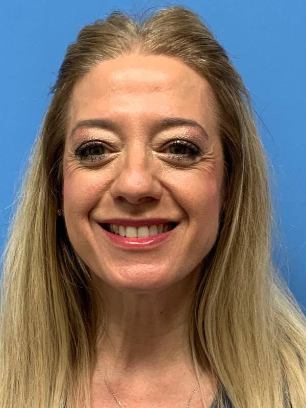 Gallery Before & After Image