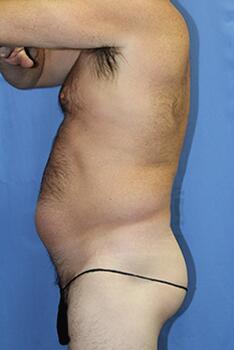 Gallery Before & After Image