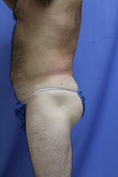 Gallery Before & After Image