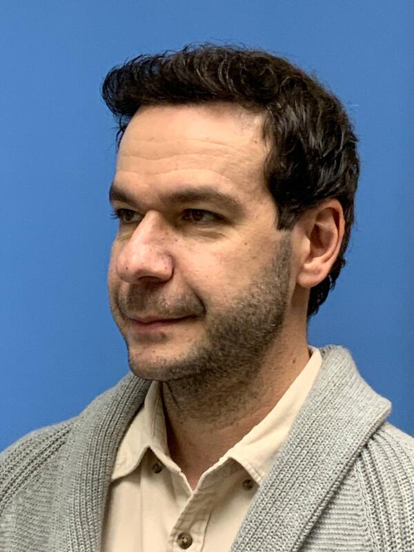 Sculptra Before & After Image